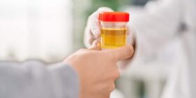 Novo dispositivo pode detectar câncer e Parkinson através da urina