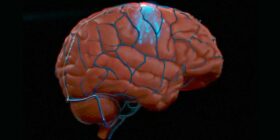 Rival da Neuralink anuncia grande ensaio clínico de implante cerebral