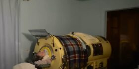 Pulmão de ferro: conheça a máquina deu mais de 70 anos de vida a homem com paralisia