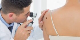 Ciência avança em vacina contra o câncer de pele