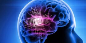 Visão artificial pode ser próximo passo para os chips cerebrais