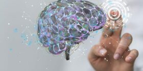 IA é capaz de entender relação entre atividade cerebral e doenças; entenda