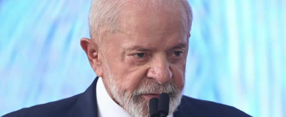 Hospital divulga exame de Lula, depois de acidente doméstico