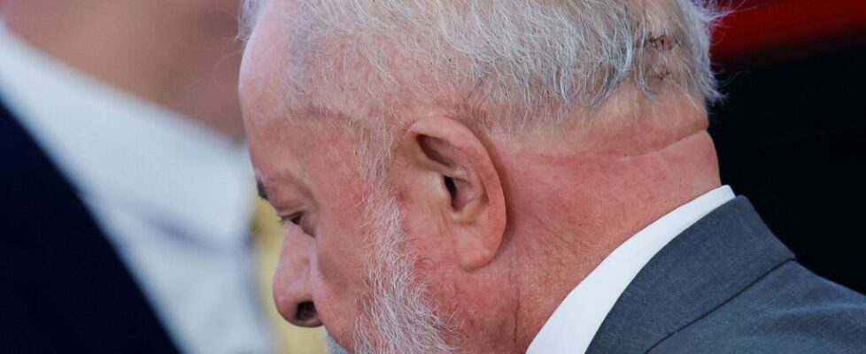 Lula retirou dreno e está sob cuidados ‘intensivos’