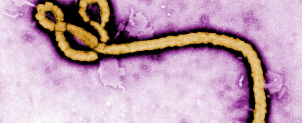 Scientists apply optical pooled CRISPR screening to identify potential new Ebola drug targets