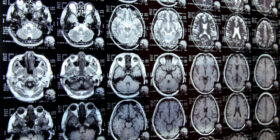 New AI system could accelerate clinical research