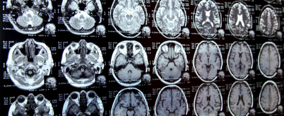 New AI system could accelerate clinical research