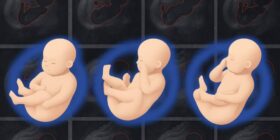 Machine-learning tool gives doctors a more detailed 3D picture of fetal health